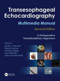 Transesophageal Echocardiography Multimedia Manual