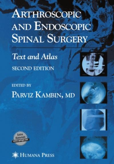 Arthroscopic and Endoscopic Spinal Surgery