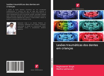 Lesões traumáticas dos dentes em crianças