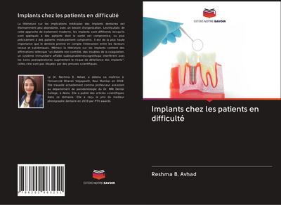 Implants chez les patients en difficulté