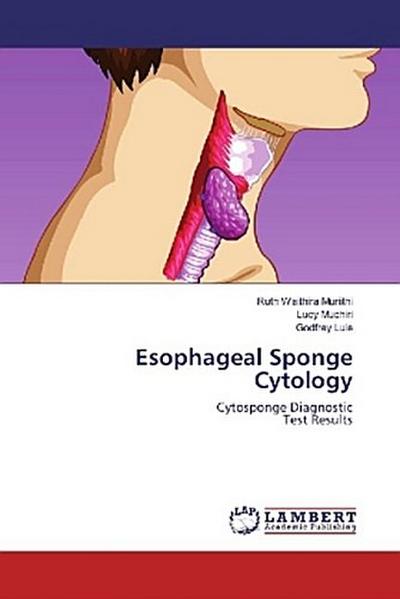 Esophageal Sponge Cytology