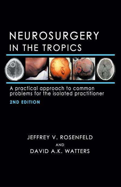 Neurosurgery in the Tropics