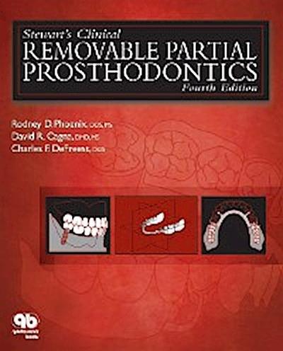 Stewart’s Clinical Removable Partial Prosthodontics