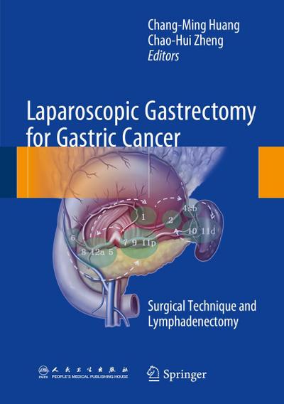 Laparoscopic Gastrectomy for Gastric Cancer