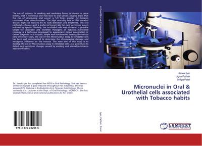 Micronuclei in Oral & Urothelial cells associated with Tobacco habits