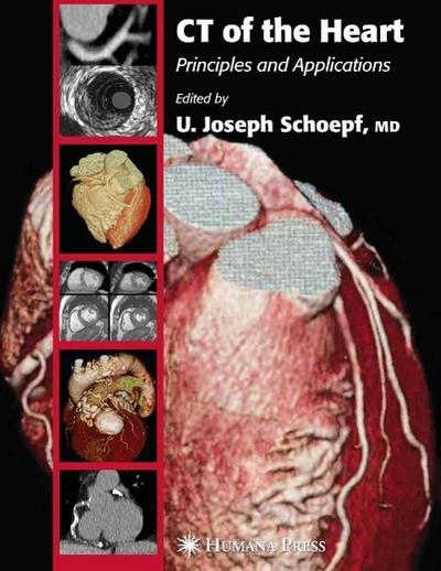 CT of the Heart