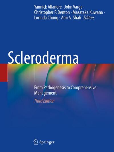 Scleroderma