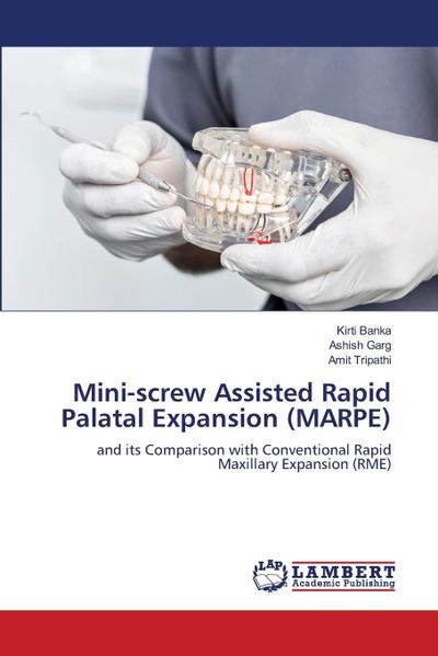 Mini-screw Assisted Rapid Palatal Expansion (MARPE)