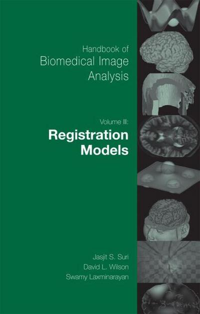 Handbook of Biomedical Image Analysis