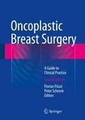Oncoplastic Breast Surgery