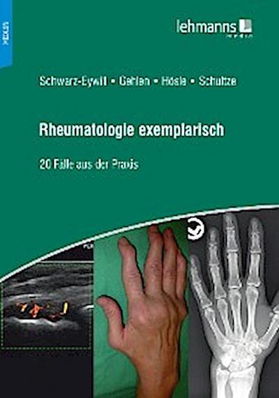 Rheumatologie exemplarisch
