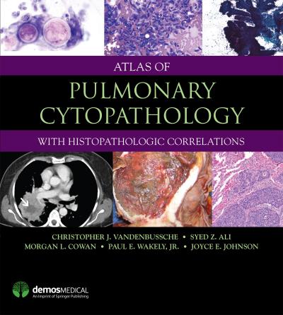 Atlas of Pulmonary Cytopathology