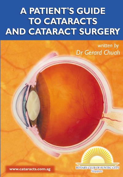 A Patient’s Guide To Cataracts And Cataract Surgery