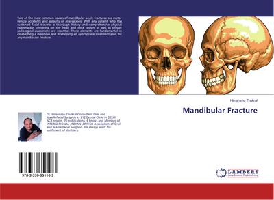 Mandibular Fracture