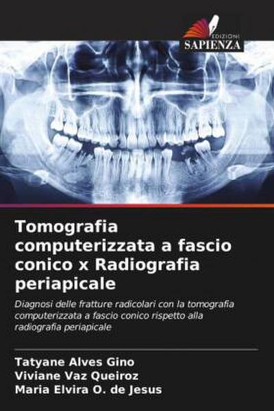 Tomografia computerizzata a fascio conico x Radiografia periapicale