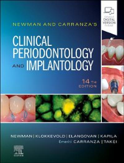 Newman and Carranza’s Clinical Periodontology and Implantology E-Book