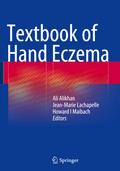 Textbook of Hand Eczema