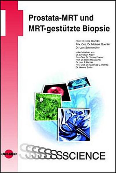 Prostata-MRT und MRT-gestützte Biopsie