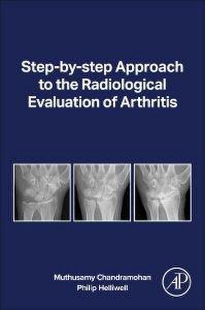Radiological Eval of Arthritis