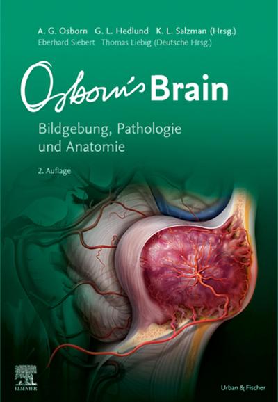 Osborn’s Brain