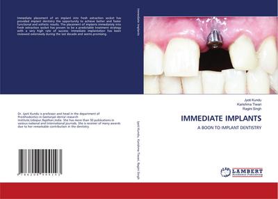 IMMEDIATE IMPLANTS