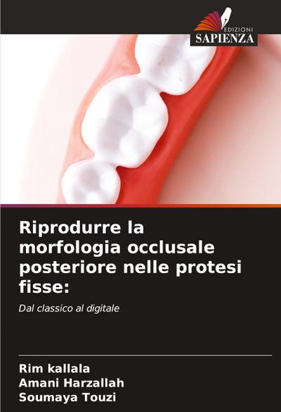 Riprodurre la morfologia occlusale posteriore nelle protesi fisse: