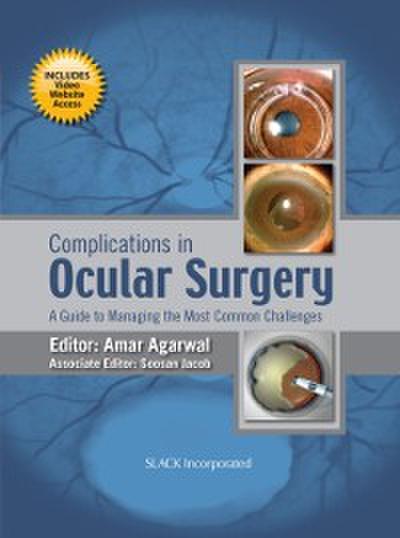 Complications in Ocular Surgery