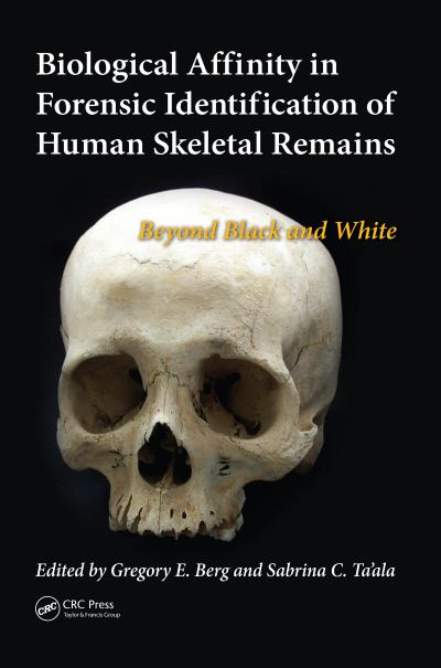 Biological Affinity in Forensic Identification of Human Skeletal Remains