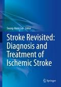 Stroke Revisited: Diagnosis and Treatment of Ischemic Stroke