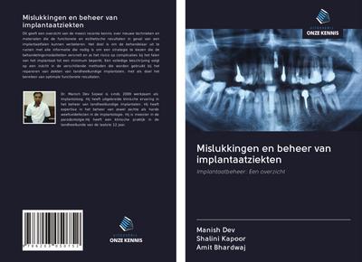 Mislukkingen en beheer van implantaatziekten