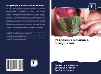 Retrakciq klykow w ortodontii