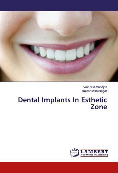Dental Implants In Esthetic Zone