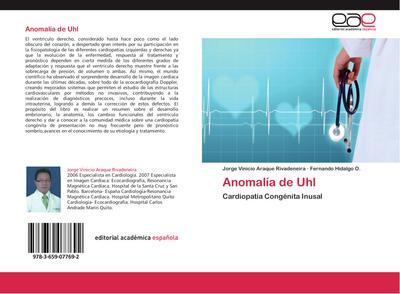 Anomalía de Uhl