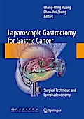 Laparoscopic Gastrectomy for Gastric Cancer