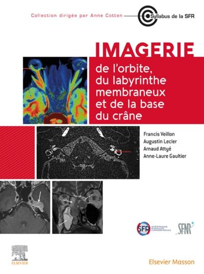 Imagerie de l’orbite, du labyrinthe membraneux et de la base du crane