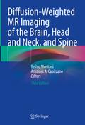 Diffusion-Weighted MR Imaging of the Brain, Head a