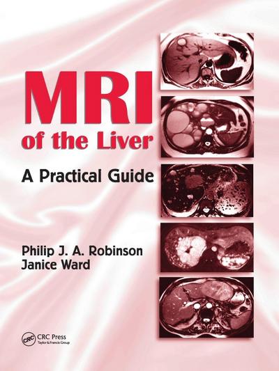 MRI of the Liver