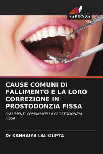 CAUSE COMUNI DI FALLIMENTO E LA LORO CORREZIONE IN PROSTODONZIA FISSA