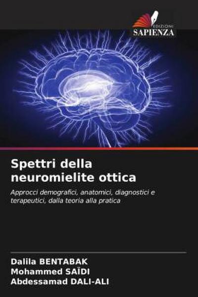 Spettri della neuromielite ottica