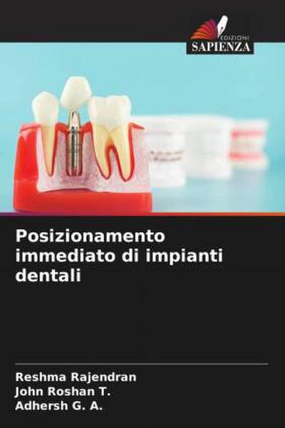 Posizionamento immediato di impianti dentali