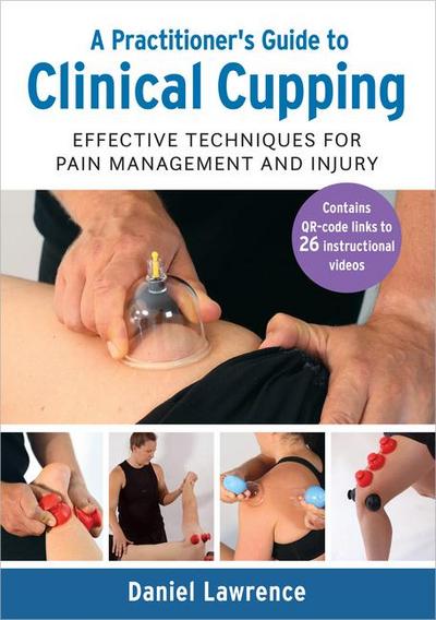 A Practitioner’s Guide to Clinical Cupping