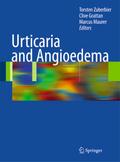 Urticaria and Angioedema
