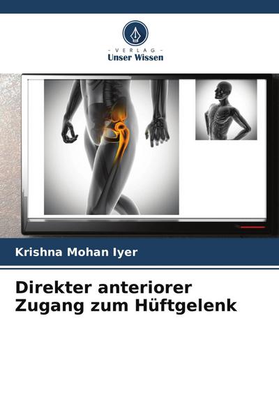 Direkter anteriorer Zugang zum Hüftgelenk