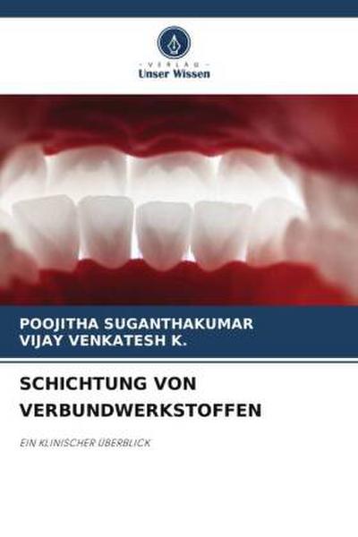SCHICHTUNG VON VERBUNDWERKSTOFFEN