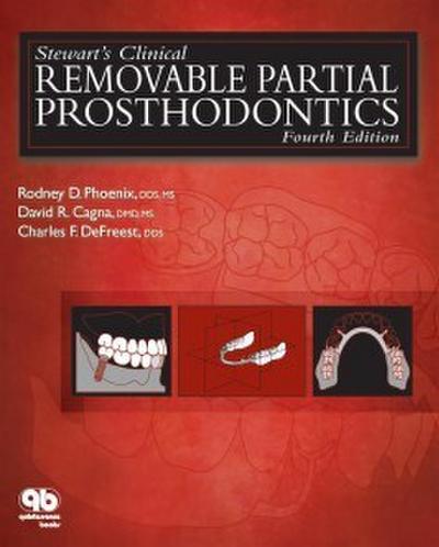 Stewart’s Clinical Removable Partial Prosthodontics (eBook, PDF) - Rodney D. Phoenix