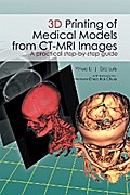 3D Printing of Medical Models  from Ct-Mri Images