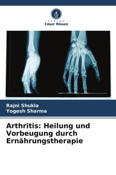 Arthritis: Heilung und Vorbeugung durch Ernährungstherapie
