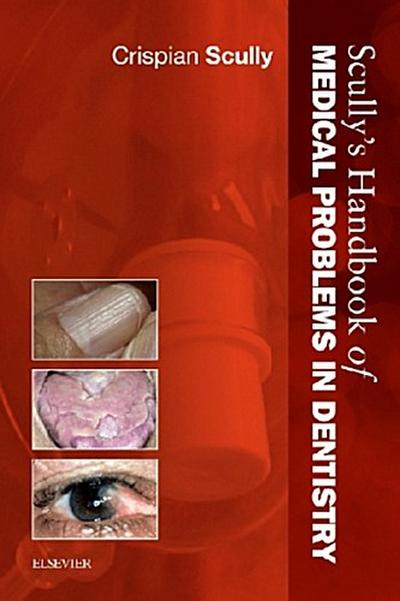 Scully’s Handbook of Medical Problems in Dentistry