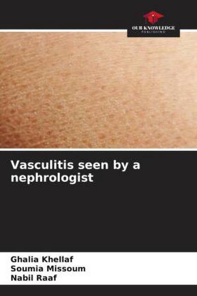 Vasculitis seen by a nephrologist