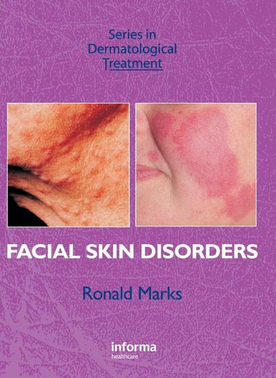 Facial Skin Disorders